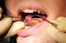 Up to 20,000 children on waiting lists for orthodontic work