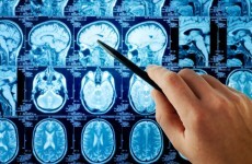 'Budding psychopaths' can be identified 'by how they react to people in pain'