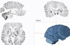 Scientists create most detailed map ever of human brain