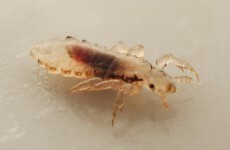 What to do if your child's hair gets infested with head lice