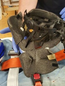 A lucky escape: This Dublin cyclist's helmet was split in three places in a crash
