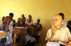 Teacher charged with trying to sell albino schoolgirl for €8,900