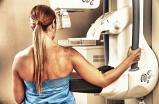 It's going to take six years to extend the breast cancer screening programme