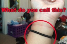 Bobbin, gogo or bobble -- what do YOU call a hair tie?