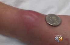 Always wear a hair tie on your wrist? Here's why you shouldn't