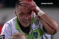 James Coughlan spills blood as Pau claim draw with Racing