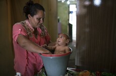 'The boy would scream uncontrollably' - Photographer describes time with 'bucket baby' in Brazil