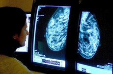 Cancer sufferers living in deprived areas 40% more likely to die
