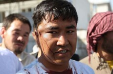 At least 80 people have been killed in Kabul bombing