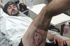 Cyclist hospitalised after iPhone 'explodes' under his leg