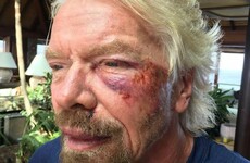 Billionaire Richard Branson thought he was going to die after falling off his bike