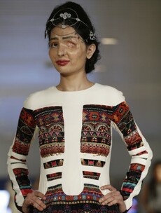 Two years after having her face doused in acid, survivor wows New York Fashion Week