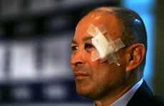 Bruised Eddie Jones retains Dylan Hartley as captain for Six Nations