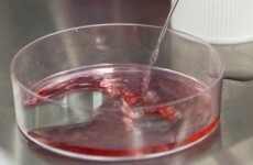 First human trial of stem cell treatment underway