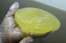 Former head of breast implant company PIP arrested in France