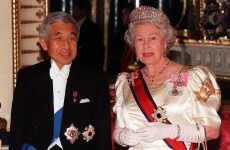 Japan's emperor to have heart bypass surgery