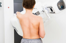 Over 25,000 women invited for a free breast check this year opted not to go