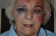 Reward offered after 'vicious' assault on pensioner in London