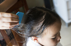 Why I'm terrified of the dreaded nits (and what you should actually do about them)