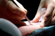 HSE hopes to clear over 31,000 medical card applications backlog by May