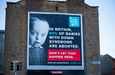 FactCheck: Are 90% of babies with Down syndrome in Britain aborted?
