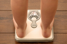 Almost a quarter of the world will be obese by 2045 researchers warn