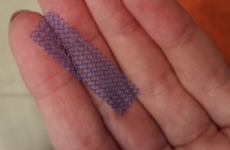 Review finds surgeons did not report women's vaginal mesh complications to watchdog