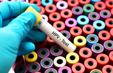 Harris asks HSE to introduce HPV testing 'as soon as possible' as roll out is pushed out due to smear test backlog
