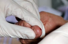 US government calls for 'baby boomer' hepatitis C testing