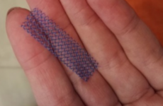 FDA orders medical device companies to stop selling pelvic mesh