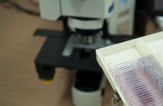 CervicalCheck scandal: HSE says 434 smears expired before testing
