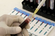 Blood tests may predict breast cancer spread