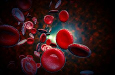Sepsis linked to 11m deaths worldwide - double what was previously thought