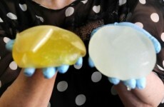 State to cover removal costs after clinic criticised over PIP breast implants