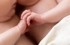 Your evening longread: An incredible mission to separate conjoined twins