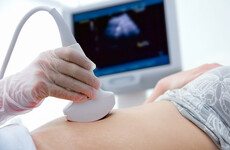 New guidance for maternity hospitals on allowing partners attend 12-week scans and C-sections