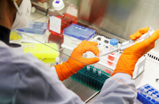 28 cases of monkeypox have been detected in Ireland