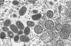 EU reviewing smallpox vaccine for use against monkeypox