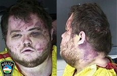 Suspect in fatal shooting at Colorado LGBTQ nightclub charged with 305 criminal counts