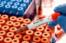 St Vincent's Hospital experiencing 'significant delays' in processing blood tests for GP patients