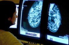 Irish Cancer Society announces €7.5 million funding for research centre