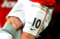 Who wants to see Wayne Rooney's cool scar? (Oh, he says he's fine by the way)