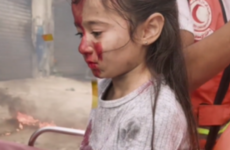 Debunked: Photo of a child actor is not proof that Palestinians are faking casualties