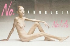 Anti-anorexia model Isabelle Caro dies at 28