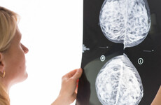 Women looking to pay cash for private breast cancer treatment due to long public wait time