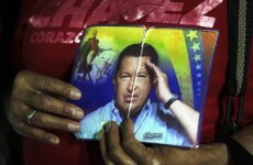 Chavez recovering after 'successful' cancer surgery