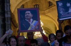 Chavez not in coma, responding well to treatment, says brother