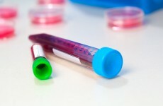 Baby born with HIV may have been cured, scientists say