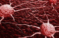Breakthrough in understanding how cancer cells 'hijack' and spread