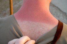 How to tell if you are an Irish person on holiday